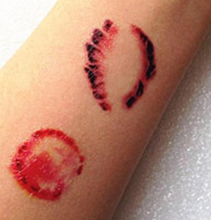 SFX Temporary tattoo - Bites & stitches