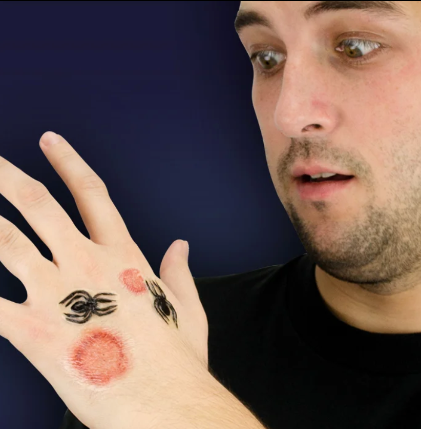 Woochie Spider Bite 3D FX Kit (Peel & Stick)