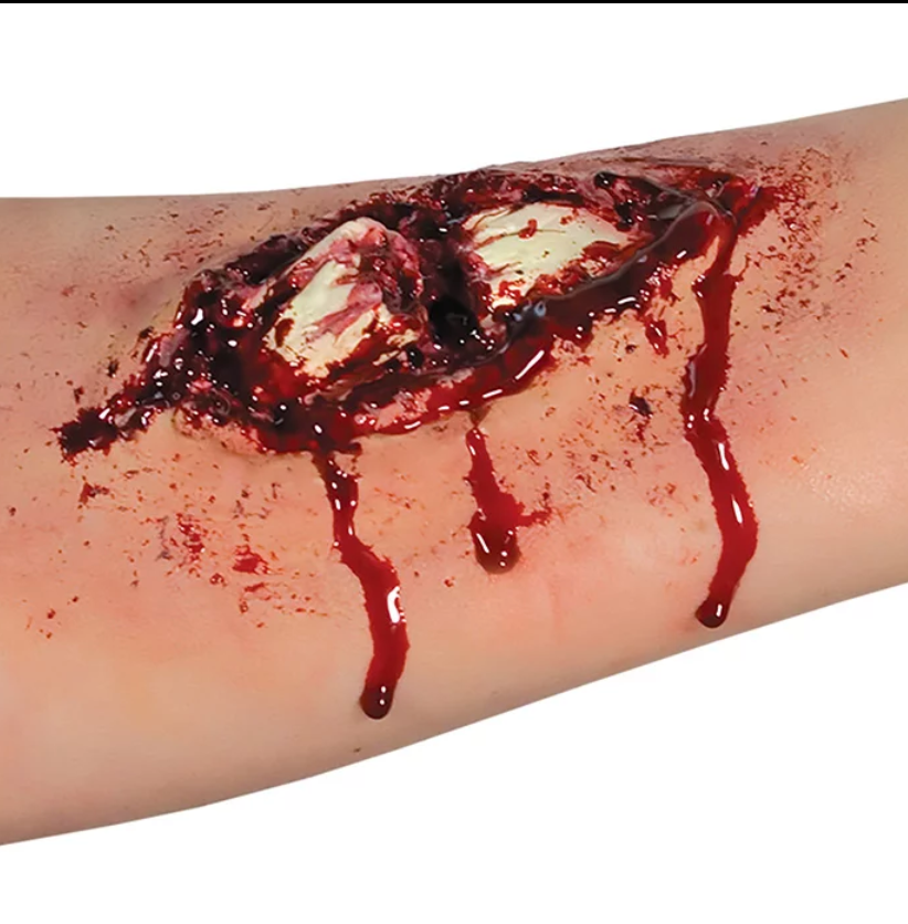 Woochie Broken Bone EZ FX Kit (Peel & Stick)