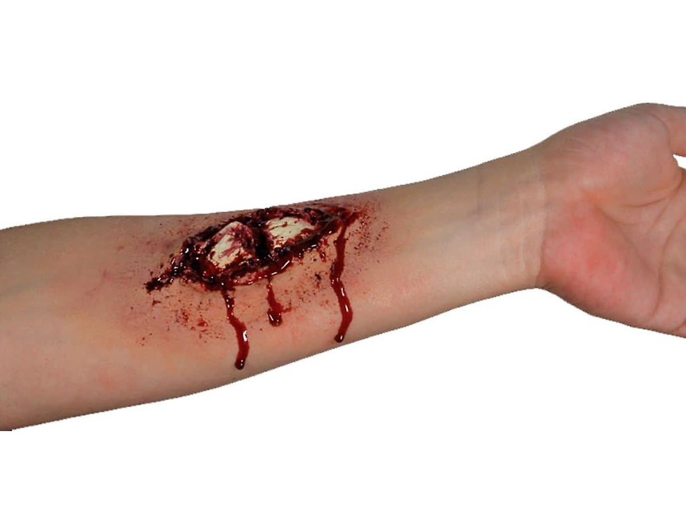 Woochie - Broken Bone