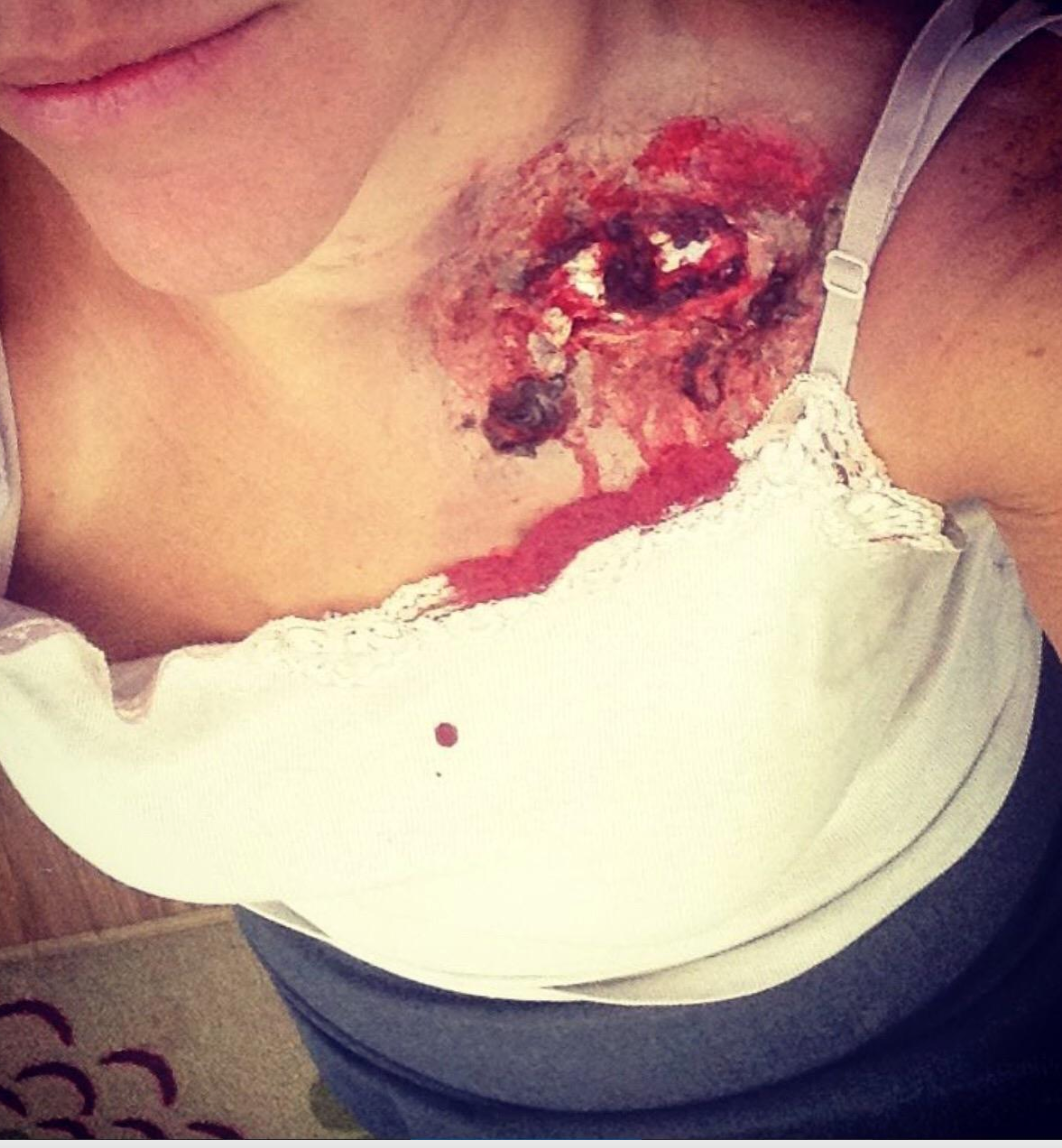 Woochie - Broken Bone