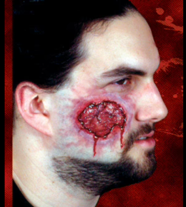 Woochie - Open wound