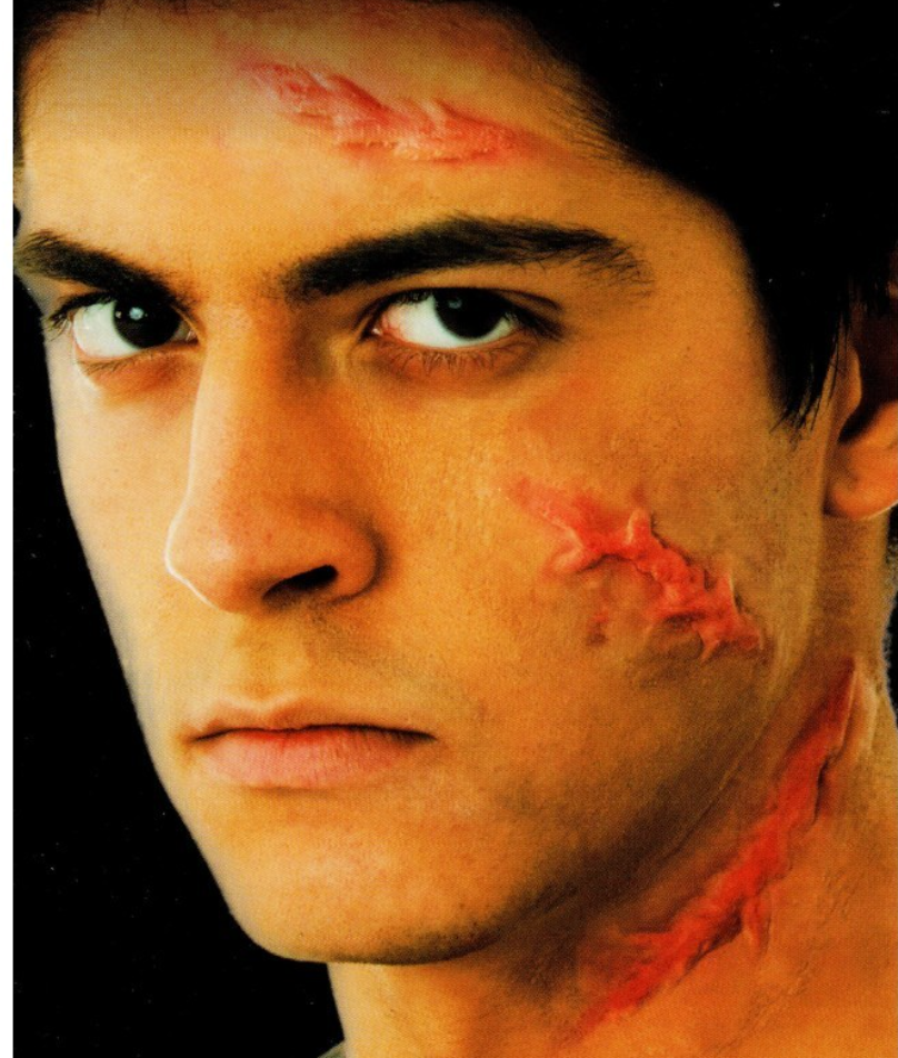 woochie - scar set appliance