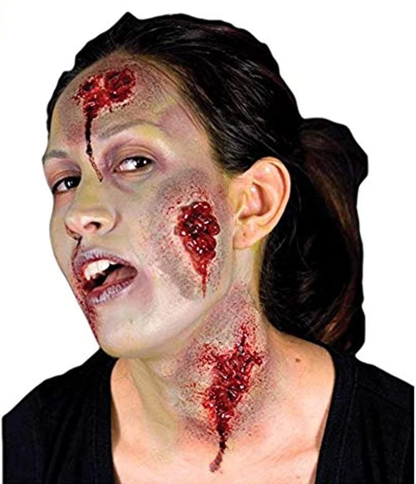 Woochie - oozing wounds