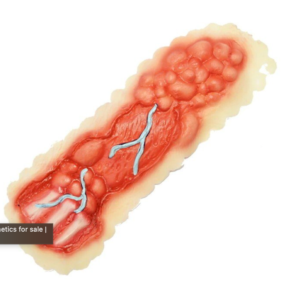 Woochie - Eaten away appliance