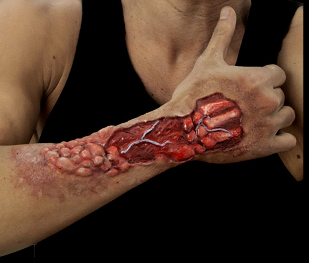 Woochie - Eaten away appliance