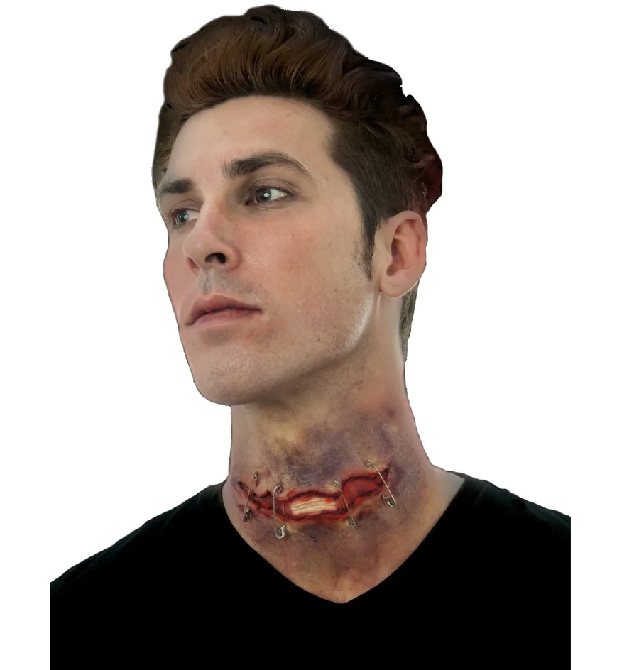 Woochie - Pinned open neck injury