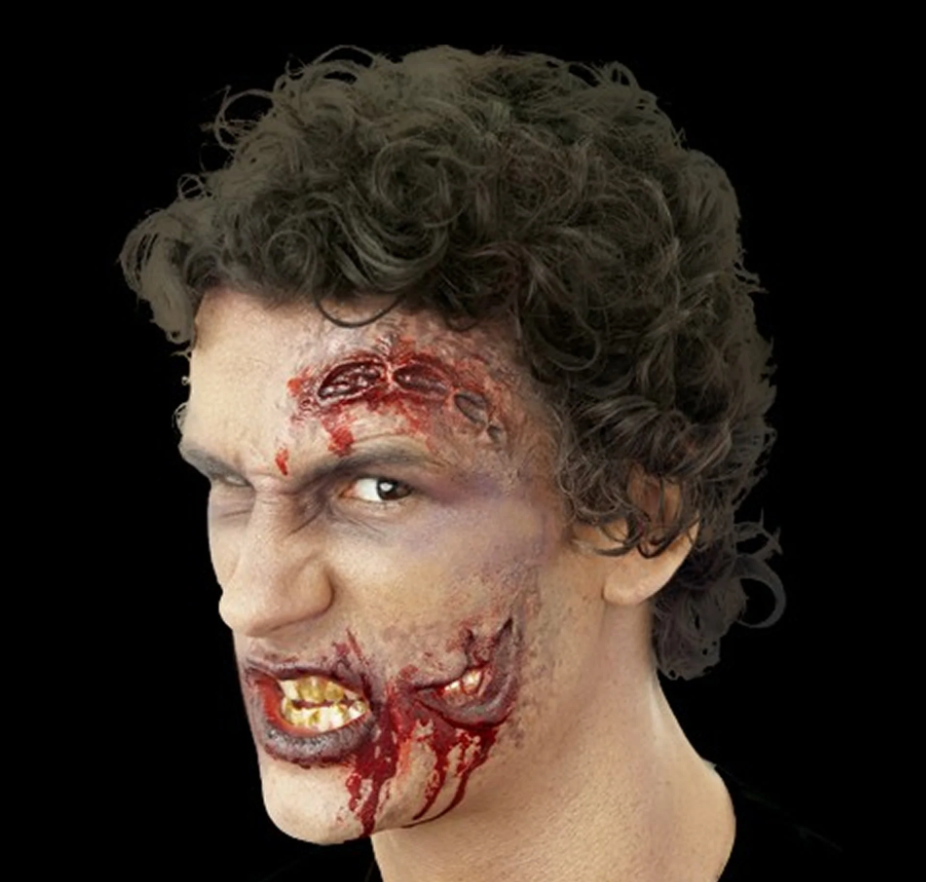 Woochie - Split open injury