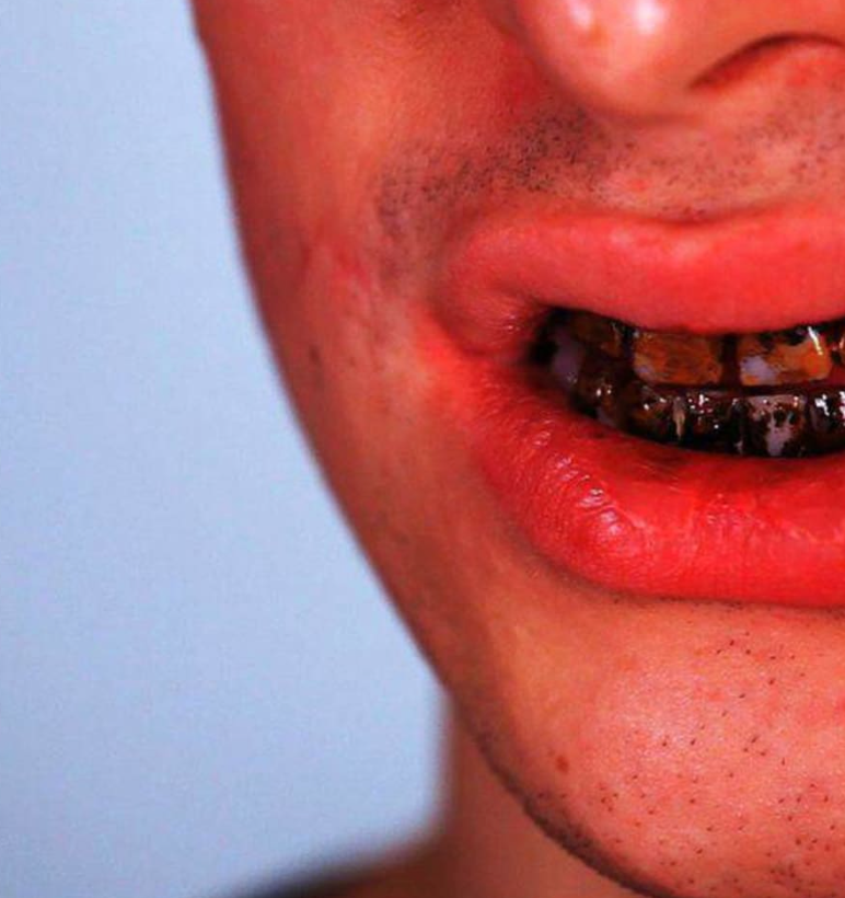 Woochie - Temporary Tooth Color - Black