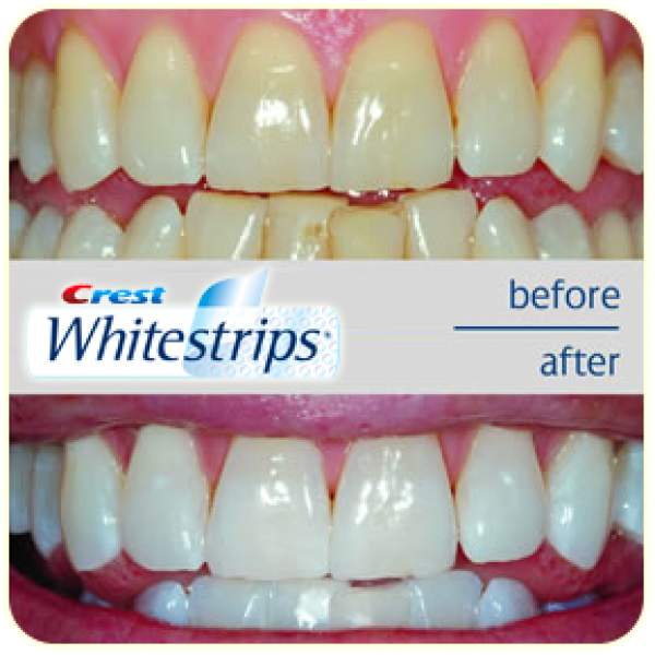 Crest professional effects whitestrips ( Bonus 2 - One hour whitening express )