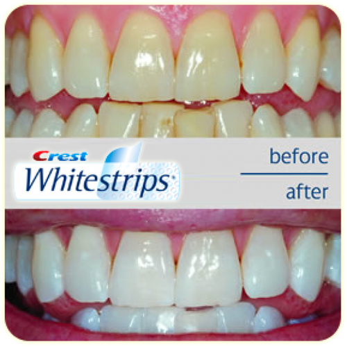 Crest professional effects whitestrips ( Bonus 2 - One hour whitening express )